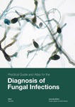 Practical guide and atlas for the diagnosis of fungal infections by Afia Zafar, Kauser Jabeen, and Joveria Farooqi